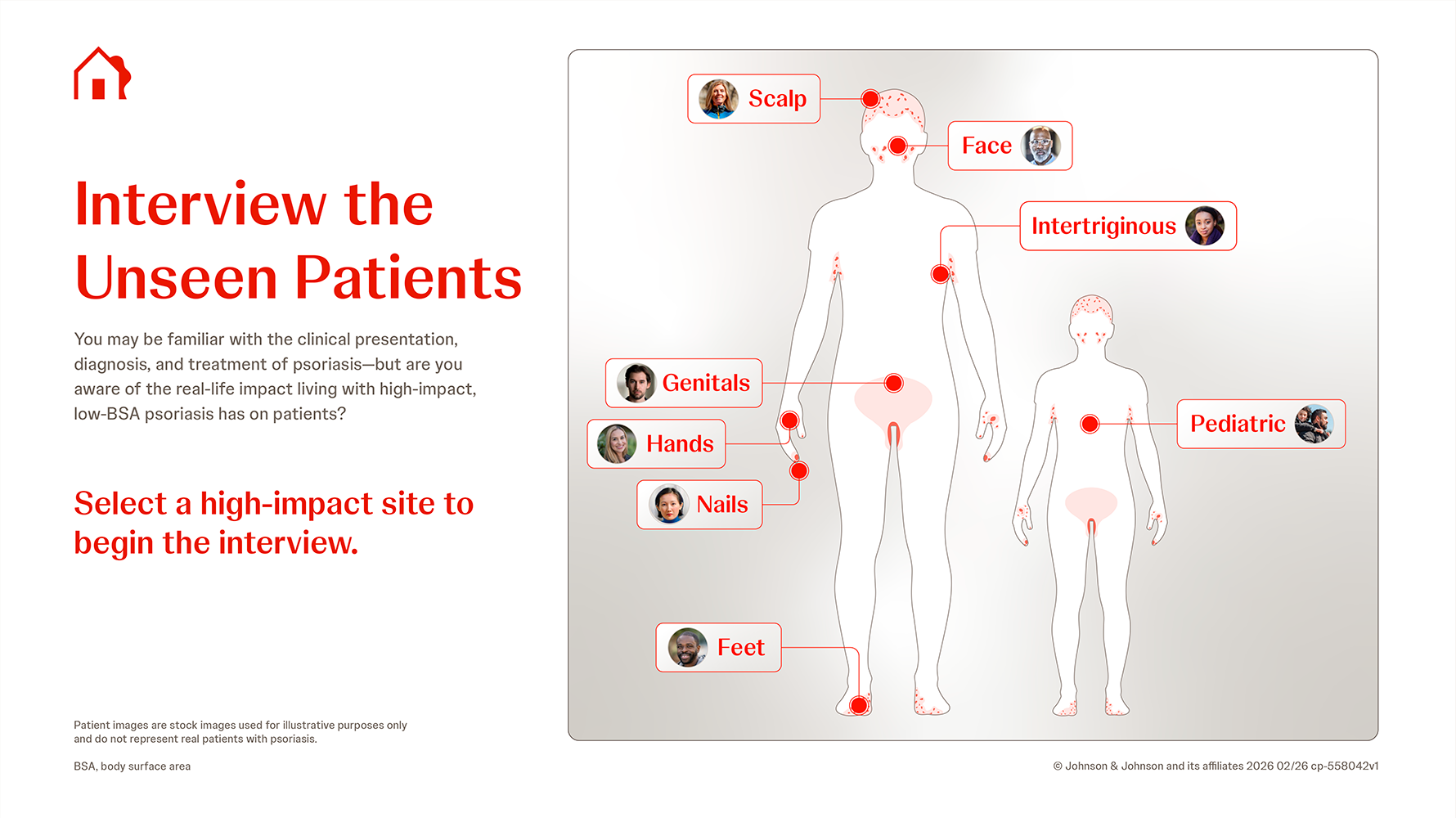Interview the Unseen Patients